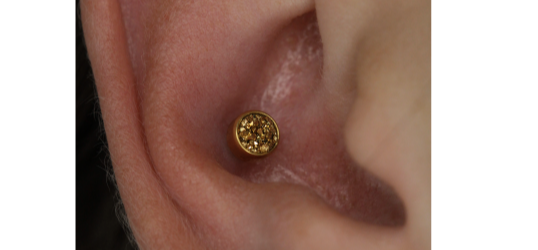 Иллюстрация прокола Конч