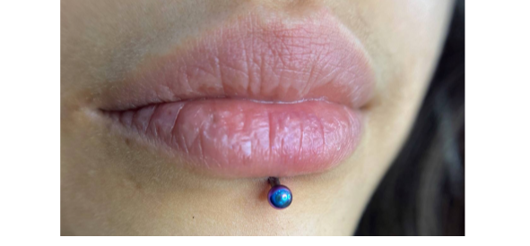 Иллюстрация прокола Лабрет