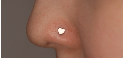 Иллюстрация прокола Нострил