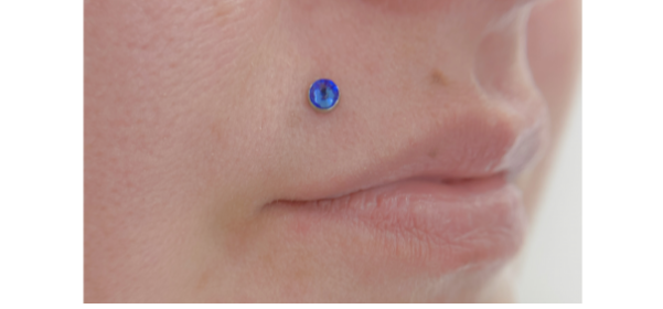 Иллюстрация прокола Монро