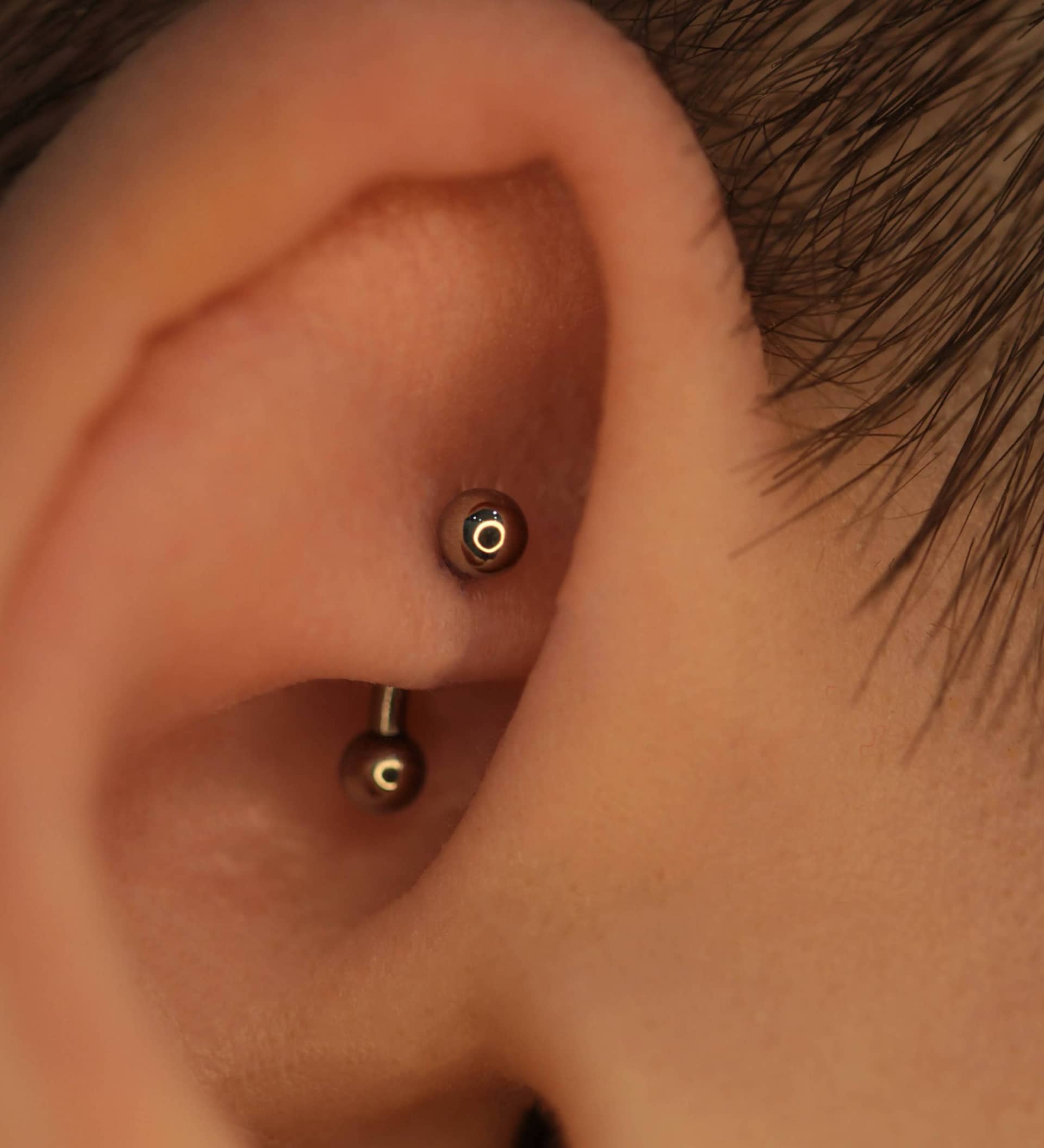 Иллюстрация прокола Rook