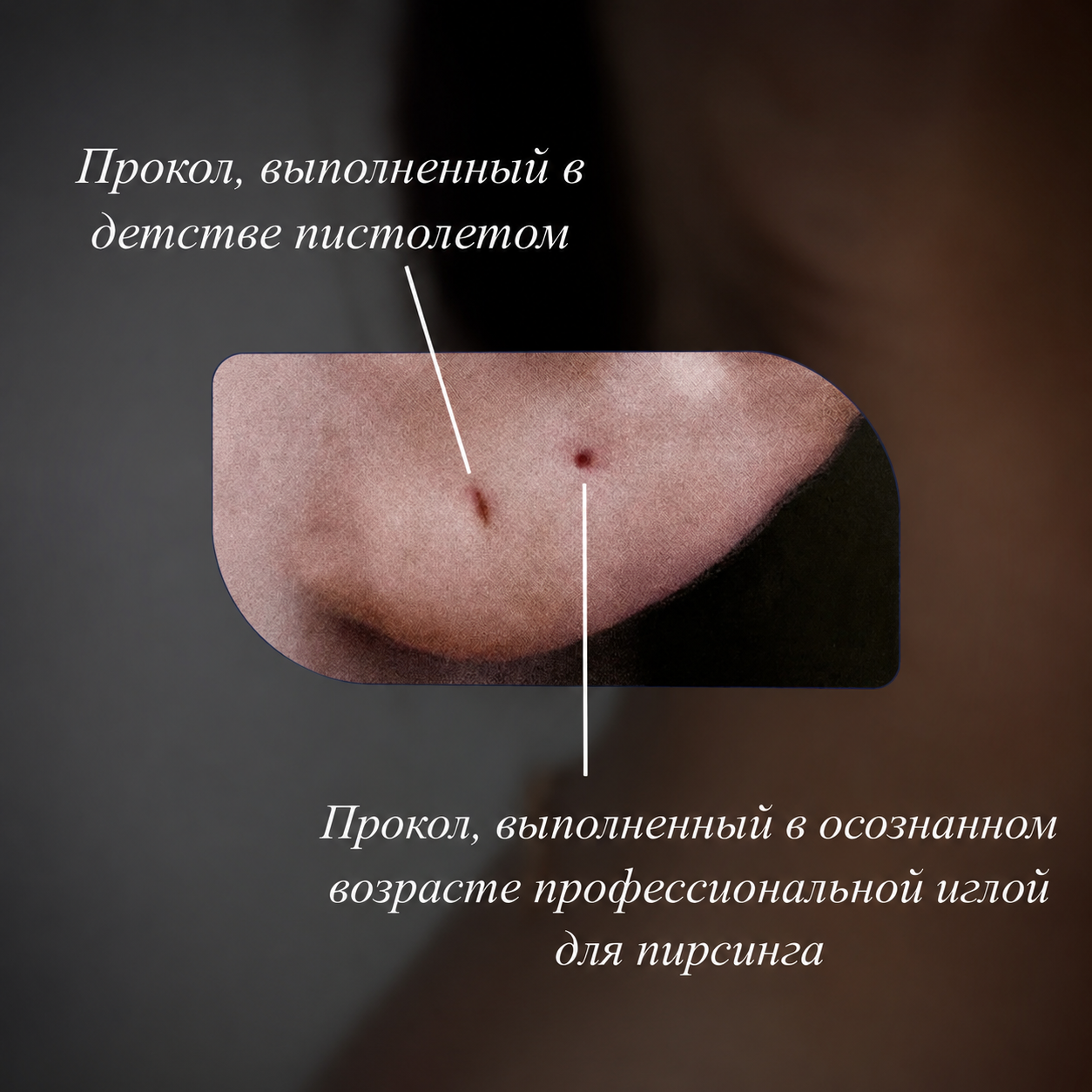 Сравнение каналов, выполненных пирсинг-пистолетом и профессиональной иглой