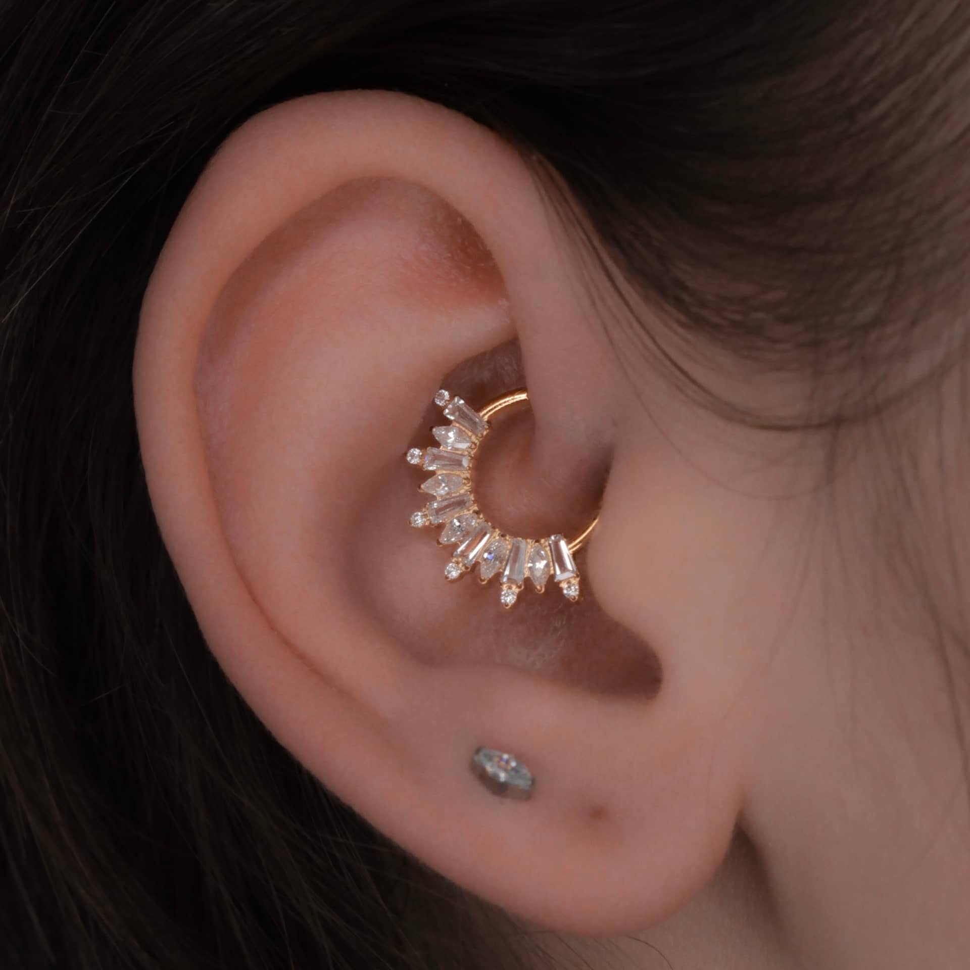 Иллюстрация прокола Daith